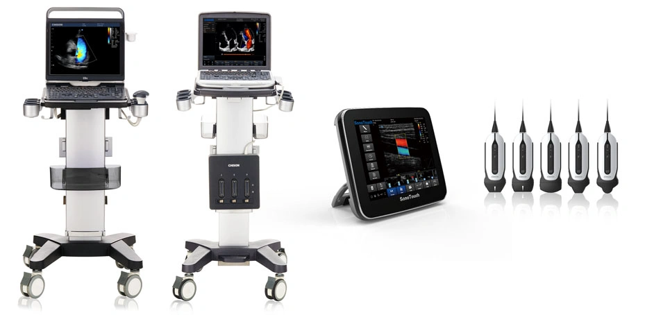 portable-ultrasound-fast-precise-diagnostics