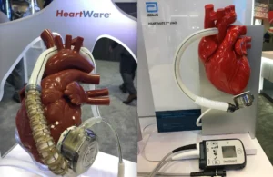 artificial-heart-a-life-saving-innovation-in-modern-medicine