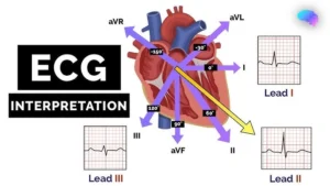 ecg-basics-understanding-heart-electrical-activity