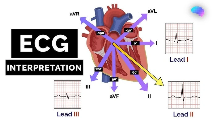 ecg-basics-understanding-heart-electrical-activity