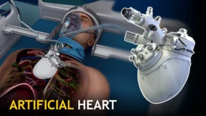 artificial-heart-a-life-saving-innovation-in-modern-medicine