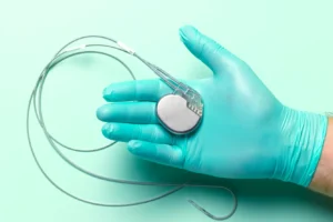modern-pacemakers-technology-and-clinical-benefits