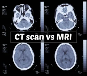 ct-scan-vs-mri-which-one-should-hospitals-prioritize