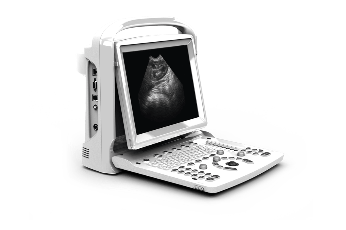 Portable Ultrasound Machine Price in Pakistan